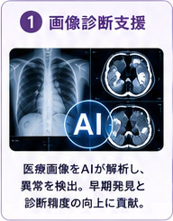 AIによる画像診断支援のイメージ